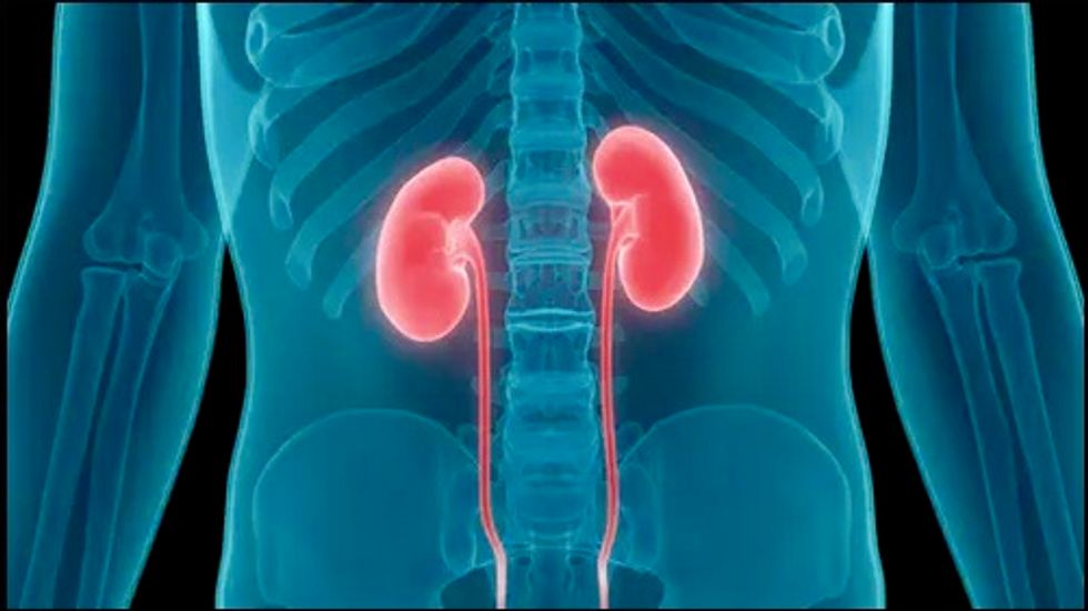 Most kidneys discarded by US would be used in France: analysis