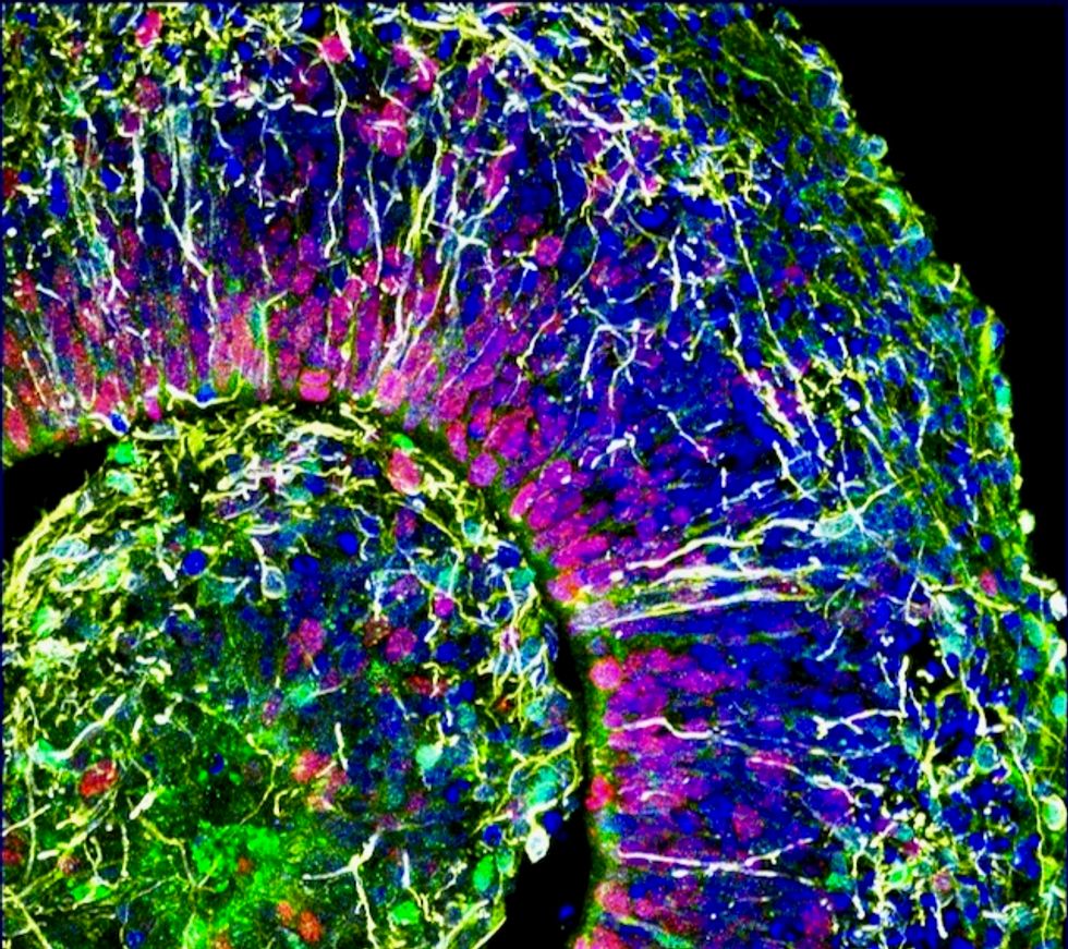 Human-like neural activity detected in lab grown mini brains