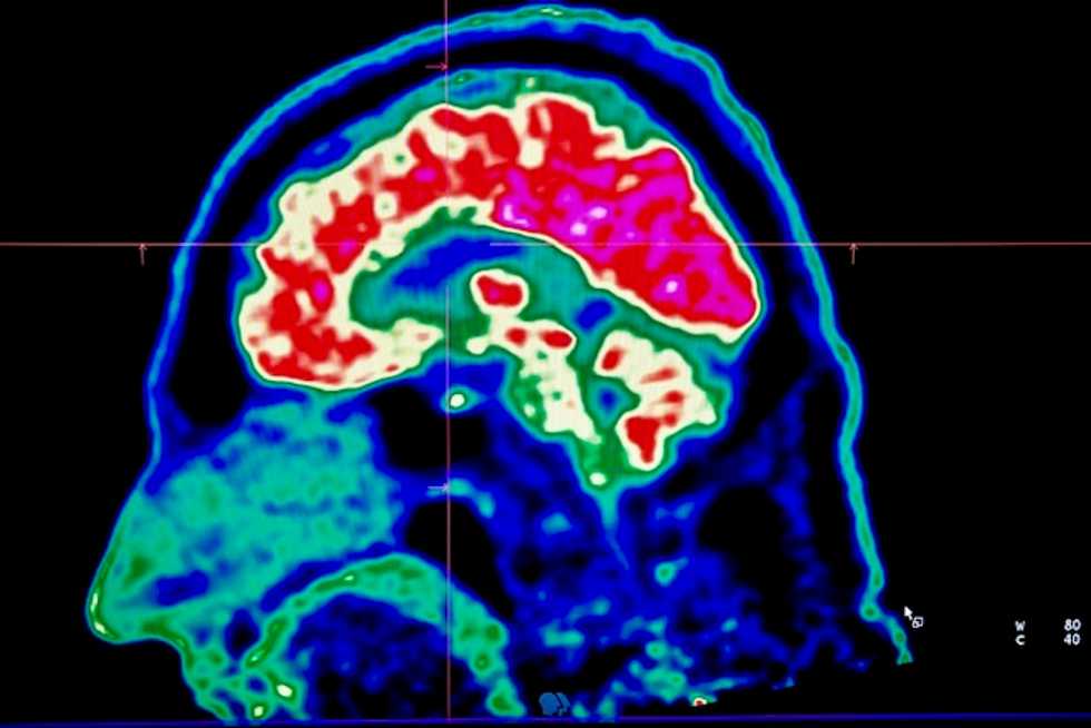 Scientists shed light on how brains turn pain up or down