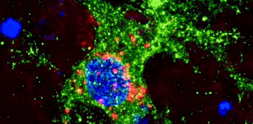 Quantum dots that light up TVs could be used for brain research