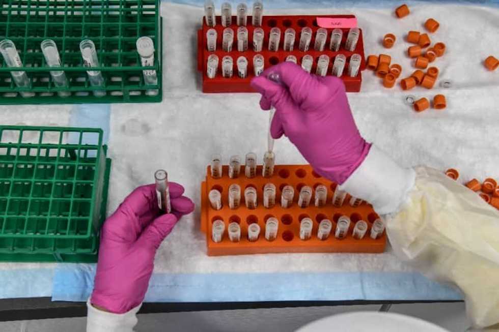 US hopes to start virus vaccines in December as pandemic surges