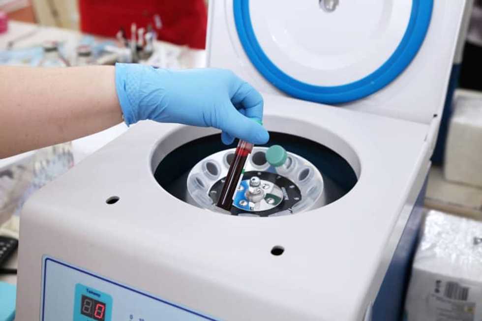 FDA gives emergency authorization to most precise coronavirus-antibody test yet