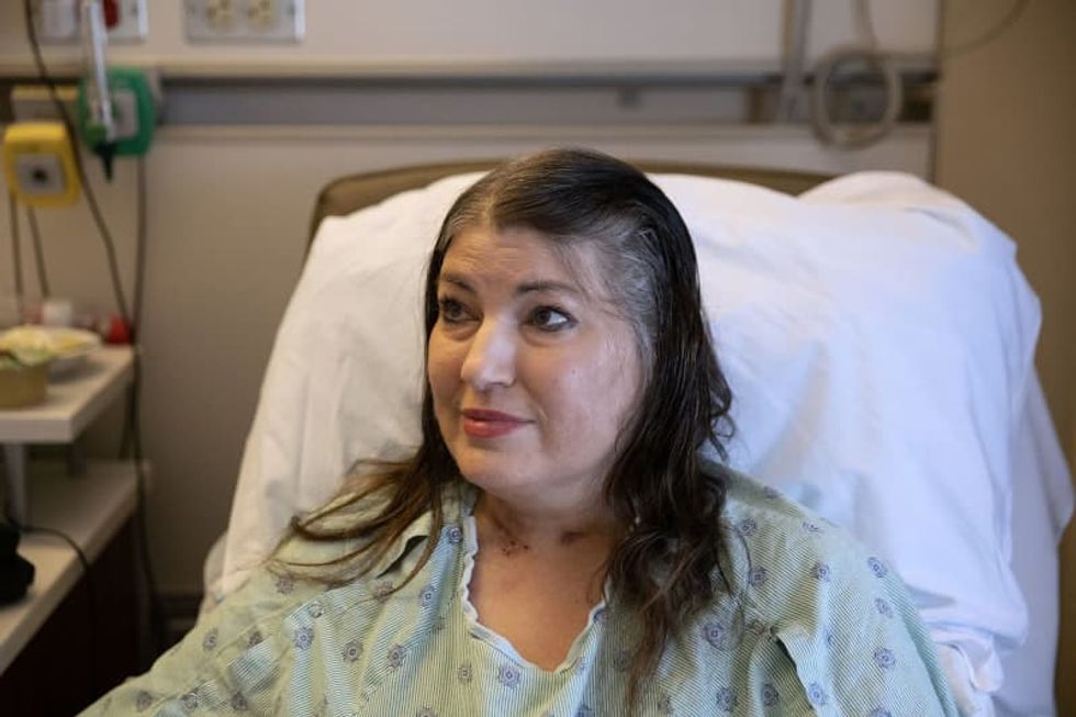 Double lung transplants are allowing seriously ill patients to survive COVID-19's 'bomb blast'
