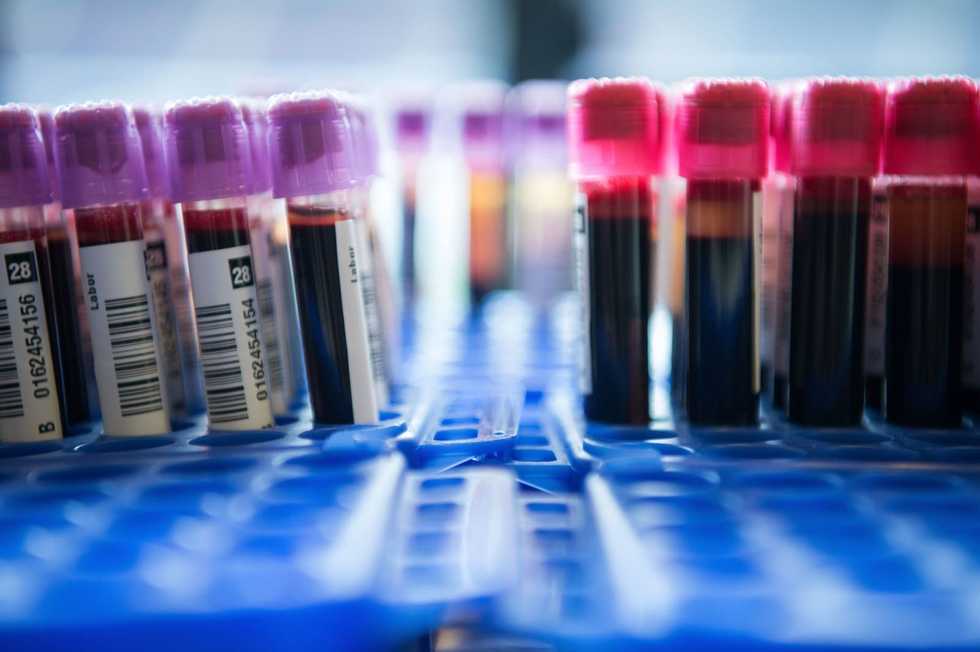 The new blood test promising to detect a variety of cancers