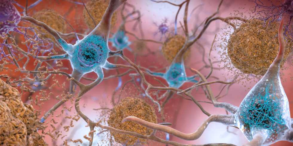 New research in mice suggests Alzheimer’s disease is linked to circadian rhythm