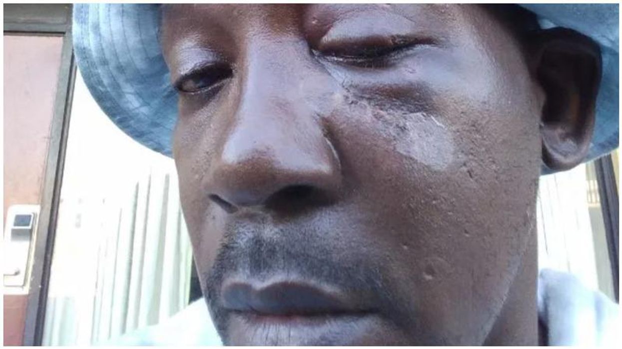 Black man says he was beaten unconscious in Mississippi after being falsely accused of burglary