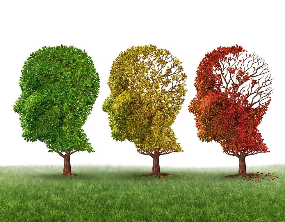 Is memory loss mild cognitive impairment, Alzheimer's or just aging? When to get tested