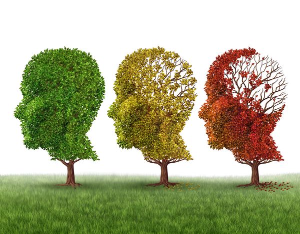 Is memory loss mild cognitive impairment, Alzheimer's or just aging? When to get tested