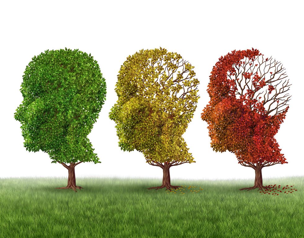 Is memory loss mild cognitive impairment, Alzheimer's or just aging? When to get tested
