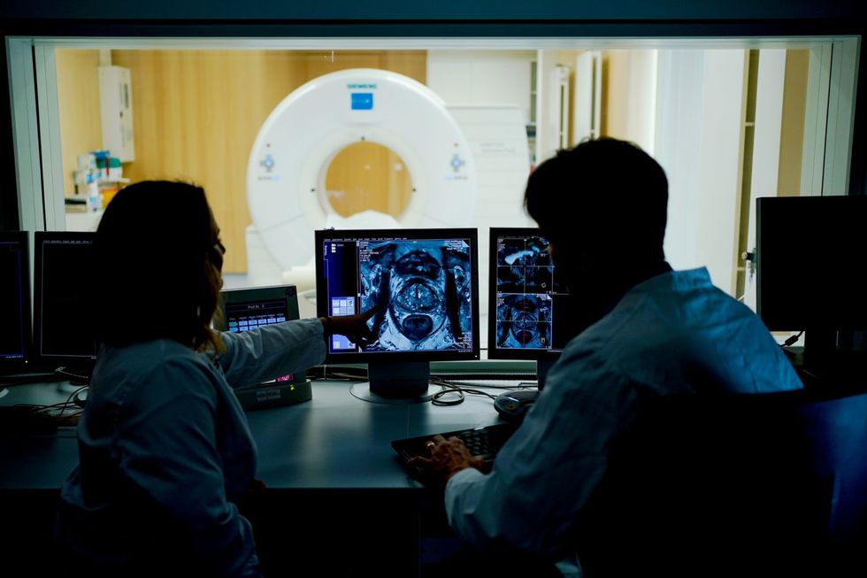 Prostate cancer deaths could be prevented if men lose weight - study