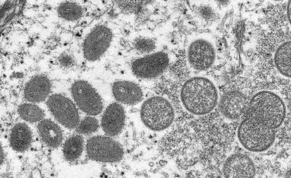 How concerned should we be about monkeypox?