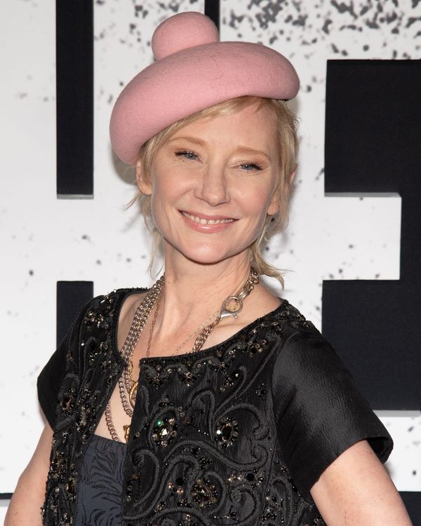 Anne Heche stable, lucky to be alive after fiery car crash