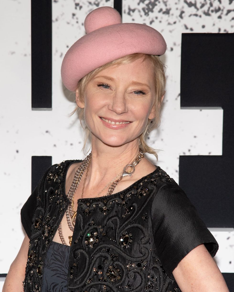 Anne Heche stable, lucky to be alive after fiery car crash