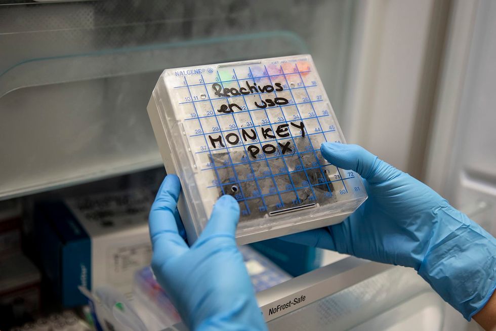 Many people don't know basic facts about monkeypox, making them susceptible to public health messaging but also to conspiracy theories - Vimarsana News