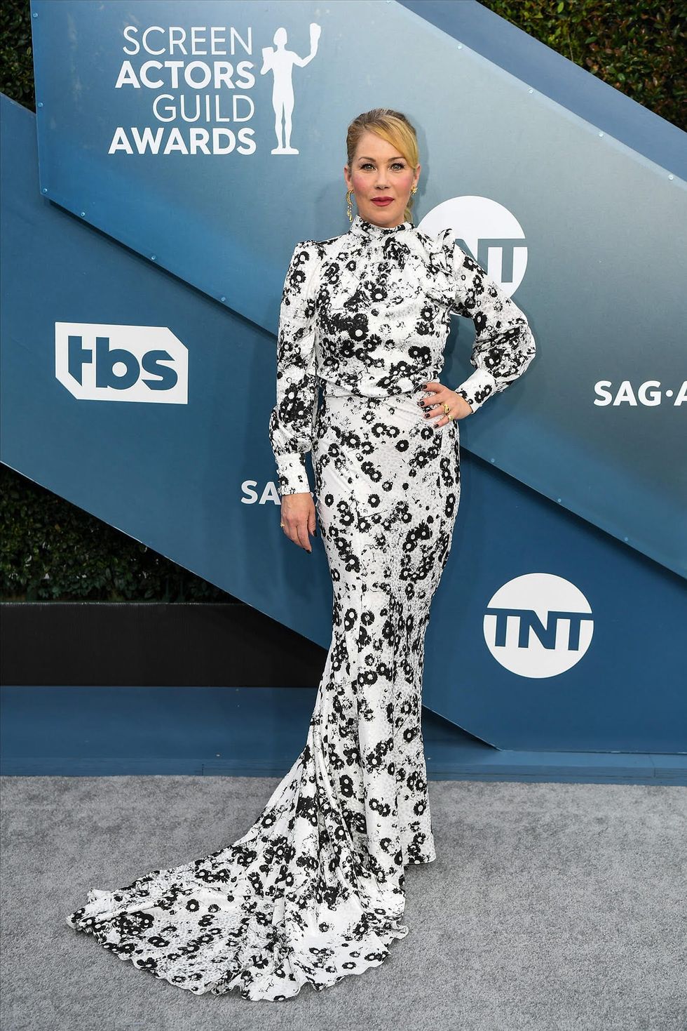 Christina Applegate might be done acting after ‘Dead to Me’ due to multiple sclerosis diagnosis