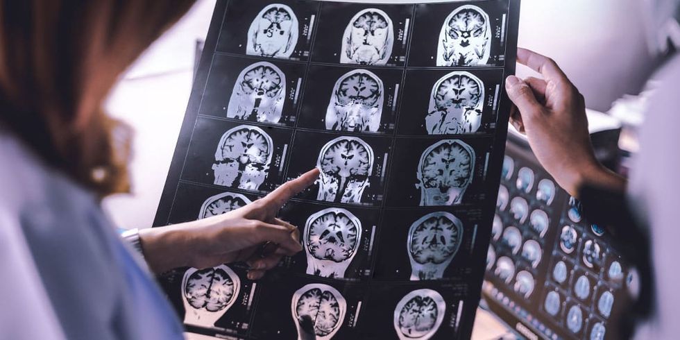 Large-scale brain lesion study identifies networks linked to greater risk or resiliency for depression symptoms