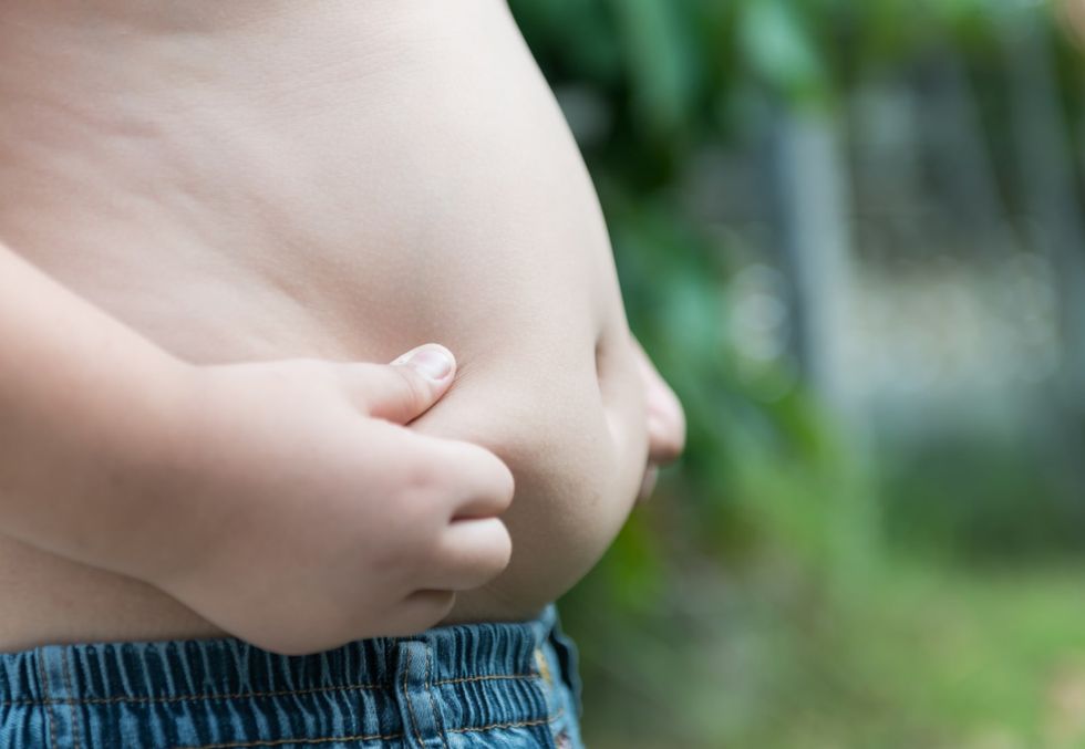 New pediatric guidelines for treating obese children include surgery and meds - Vimarsana News