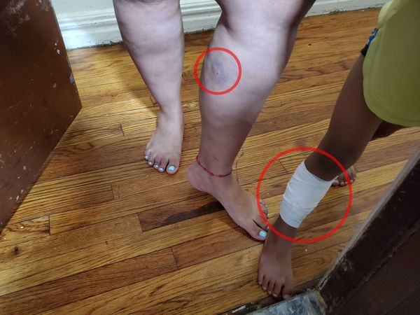 Mother of 3- and 6-year-old boys wounded in Bronx shooting: ‘I don’t feel safe to go out’