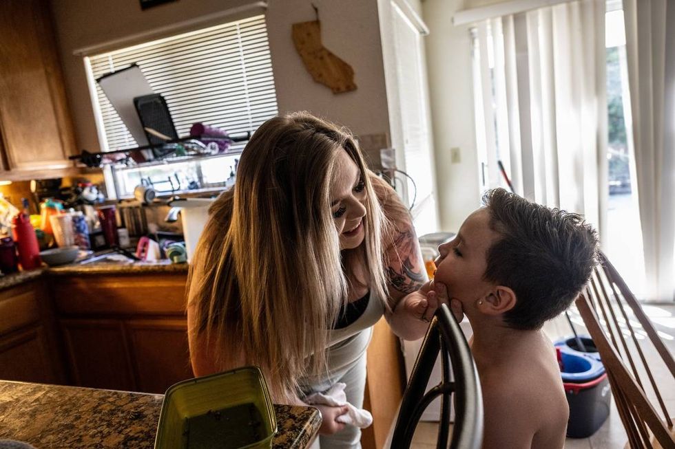 California is a reproductive rights haven. So why are women being forced into surgeries?