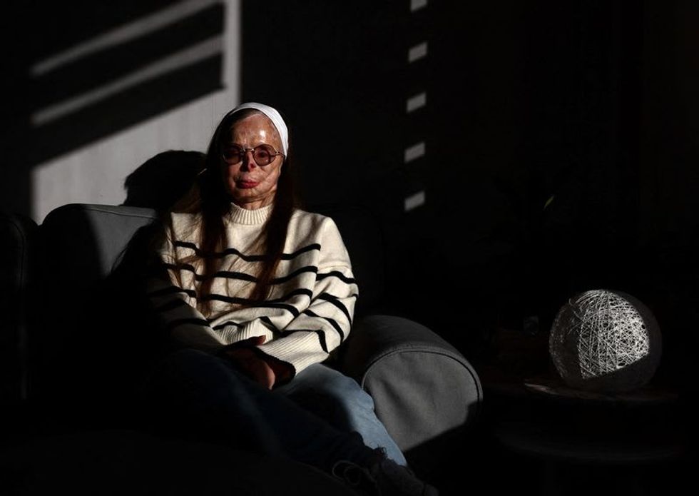 Acid attack survivor fronts fashion book in new awareness campaign