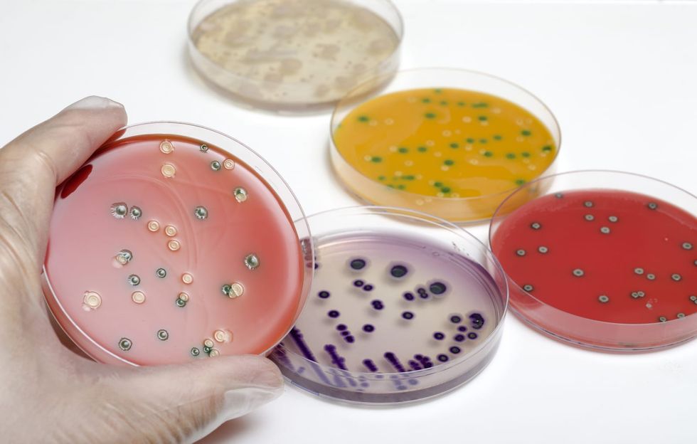 Deadly bacteria outbreak linked to cheese from California company after decade of reports