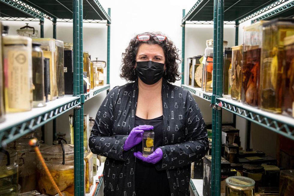 2 fetuses were mailed to Philly's Mütter Museum. Police are investigating
