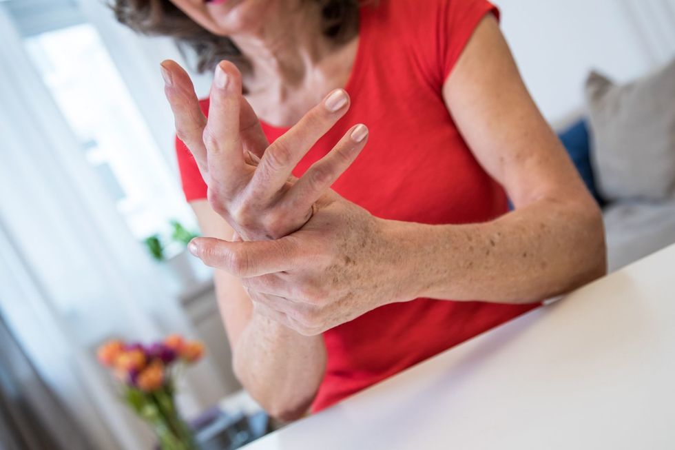 Study: Arthritis drug could prevent condition in those deemed at risk