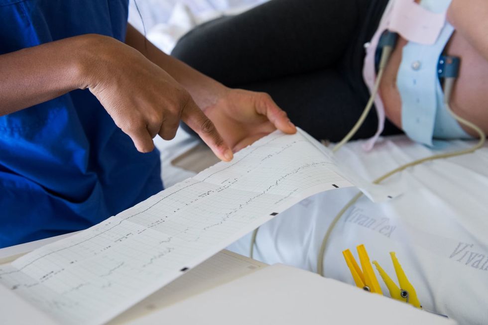 Study: Epidurals cut risk of severe childbirth complications by 35%