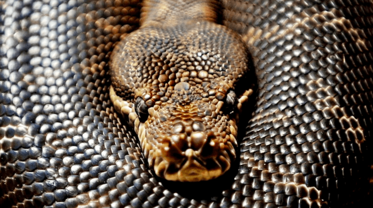 Australian doctors find live parasitic worm in woman's brain