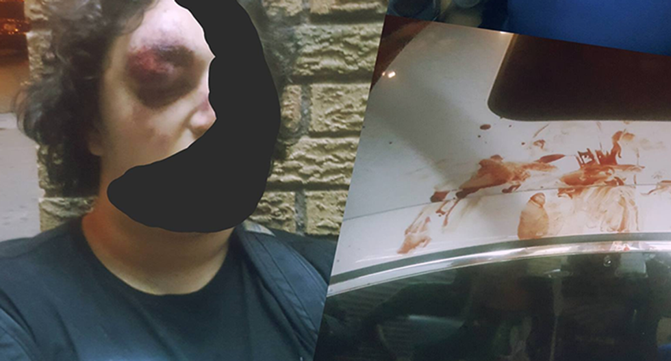 Police ignored requests to protect Brooklyn mosque before horrific attack on Muslim teens