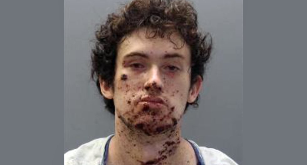 Incel blew his hand off -- and may have been planning for suicide bomber attack on ‘hot’ cheerleaders: report