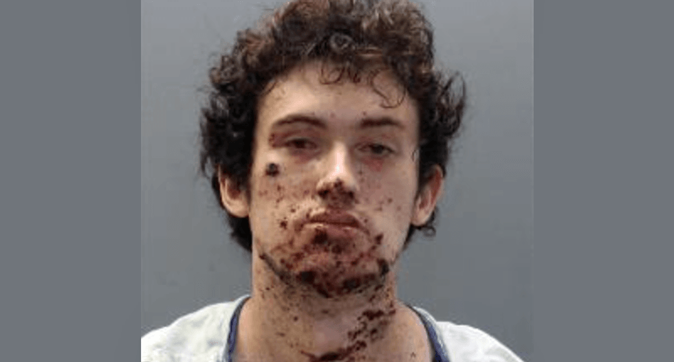 Incel blew his hand off -- and may have been planning for suicide bomber attack on ‘hot’ cheerleaders: report