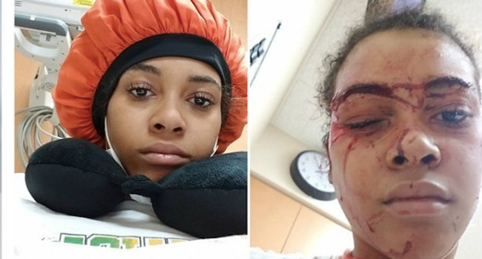 WATCH: Black woman tackled and bloodied by hospital security guard for stepping outside