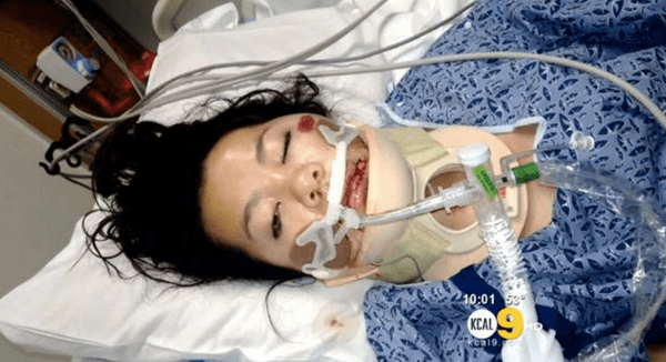Woman ejected from moving LAPD car says cop was sexually assaulting her