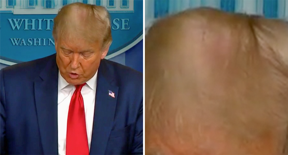 Trump’s hair focus of discussion during his press conference: ‘His comb-over no longer hides the bald spot’