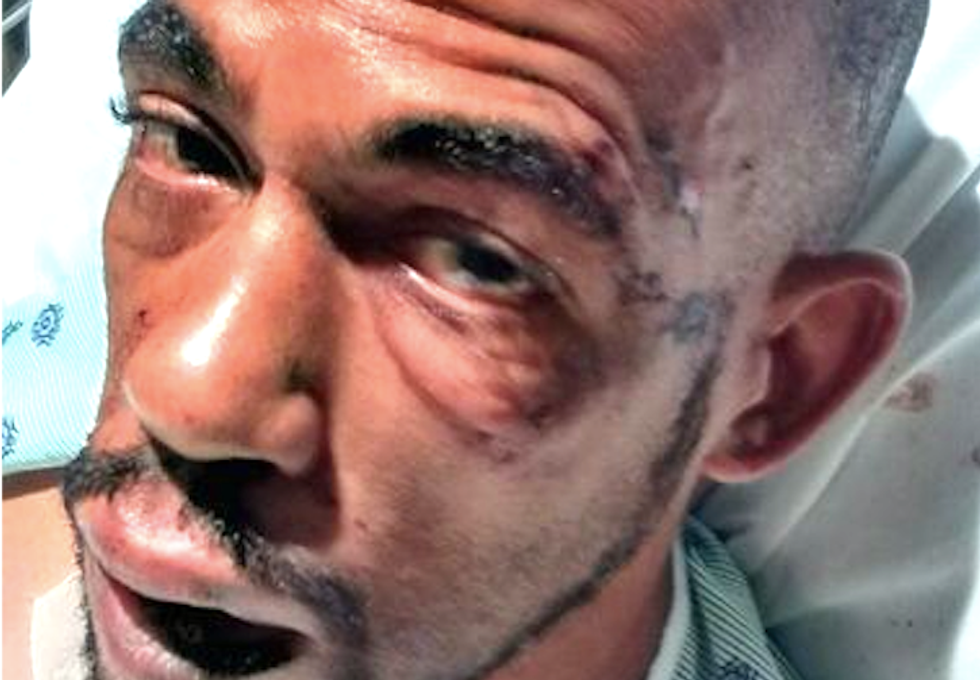 Bodycam video shows New Jersey cops assaulted black epileptic man during seizure