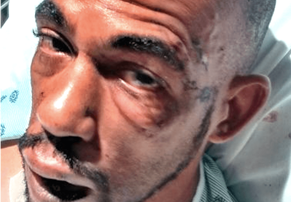 Bodycam video shows New Jersey cops assaulted black epileptic man during seizure