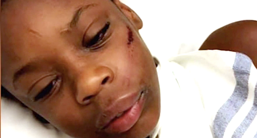 Preteen girl beaten unconscious after telling racist bully that ‘Black is beautiful’
