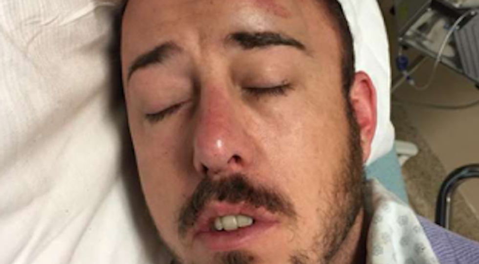 Gay man viciously attacked with rocks, boots and a belt after leaving Texas bar