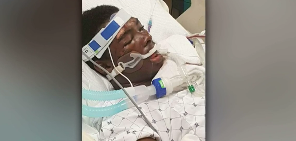 Maryland cops beat black man until his organs fail after girlfriend calls for help: attorney