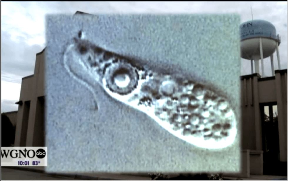 South Carolina girl dies from brain-eating amoeba