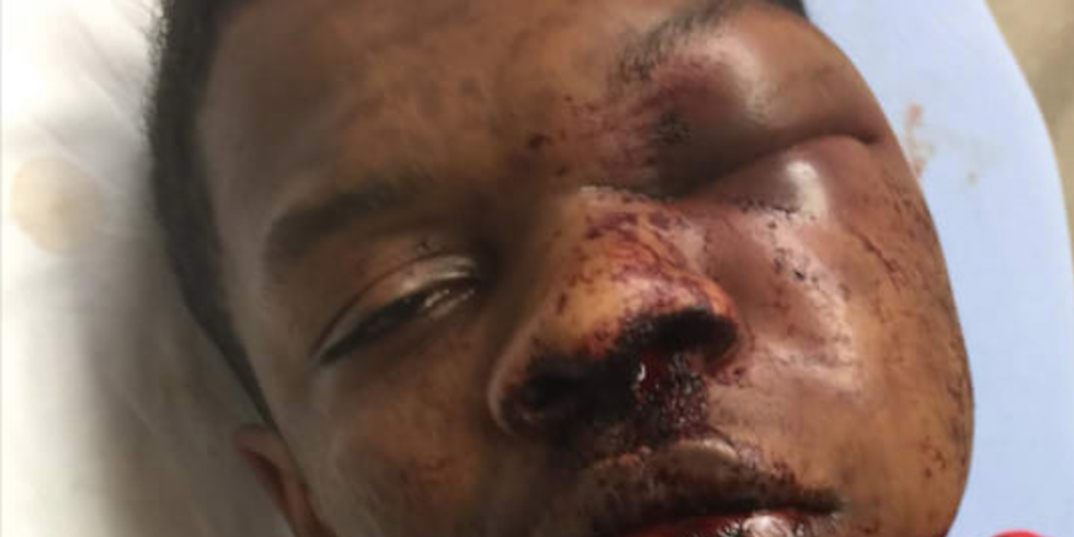 Family wants to know why Alabama police kicked and beat their handcuffed 17-year-old son