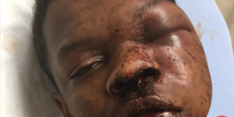 Family wants to know why Alabama police kicked and beat their handcuffed 17-year-old son