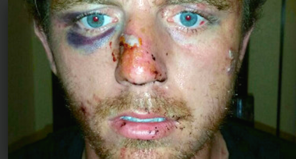 Oklahoma cop breaks man's face and charges him with assault for no apparent reason