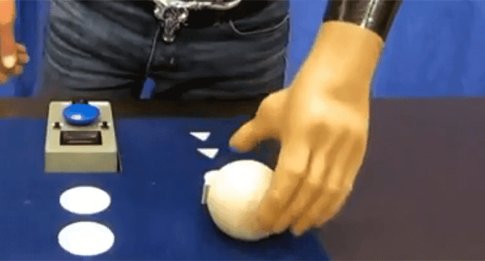 Three volunteers have their hands amputated and replaced by bionics