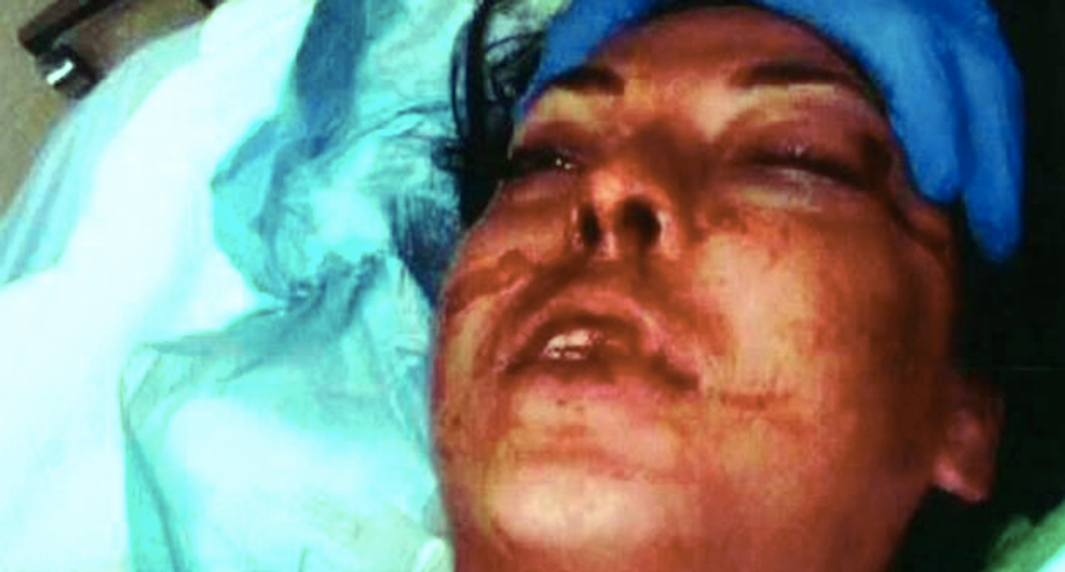 Watch: Cops break woman's face because 'she flunked the attitude test' during drunken arrest