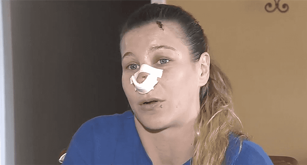 WATCH: Florida woman ruthlessly beaten with a bat by two sisters in road rage incident
