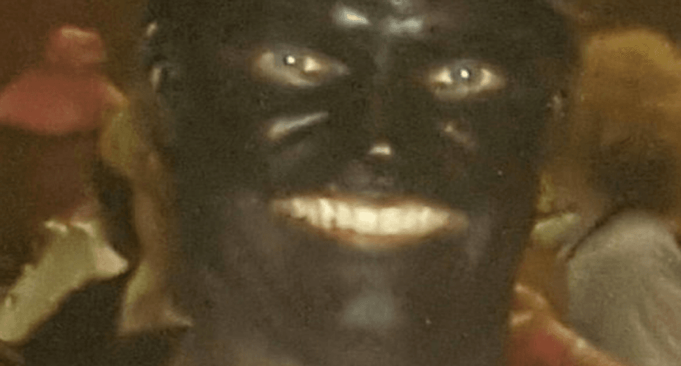 GOP frontrunner in Louisiana House race caught posing in racist Tiger Woods blackface costume
