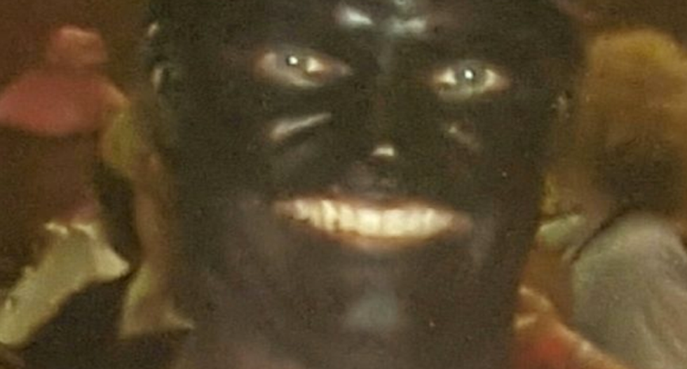 GOP frontrunner in Louisiana House race caught posing in racist Tiger Woods blackface costume