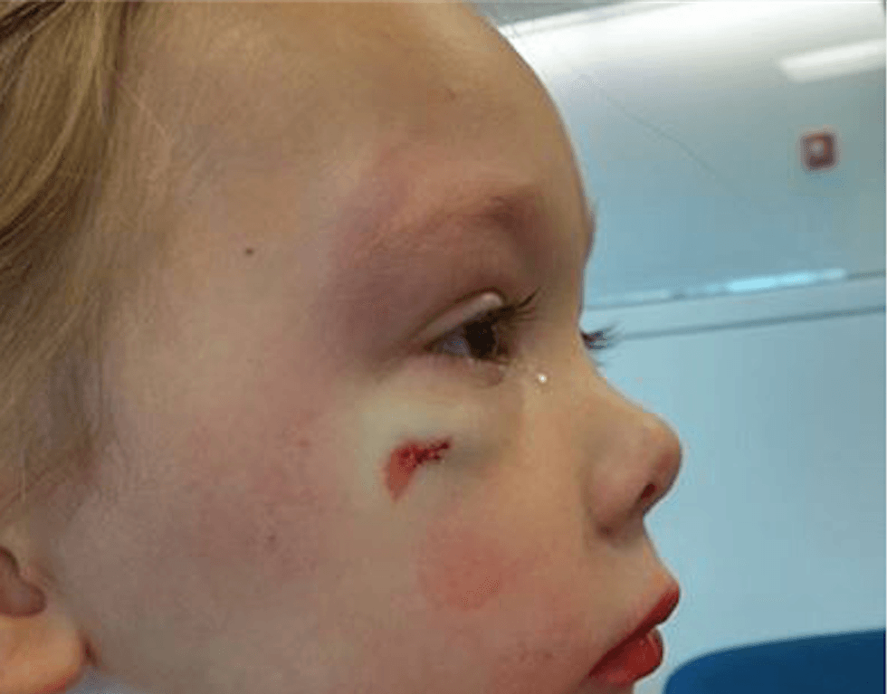 Hospital worker tells 4-year-old girl that boy who attacked her and gashed her face was just flirting